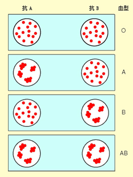 ABO血型的玻片检查法