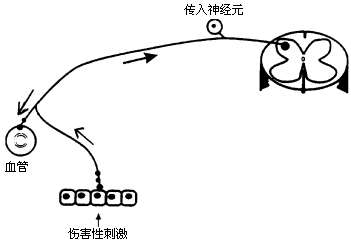 轴突反射