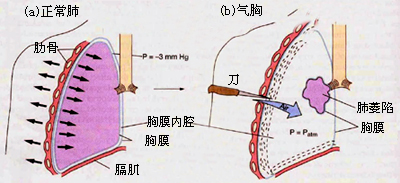 胸内压