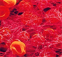 纤维蛋白网罗红细胞